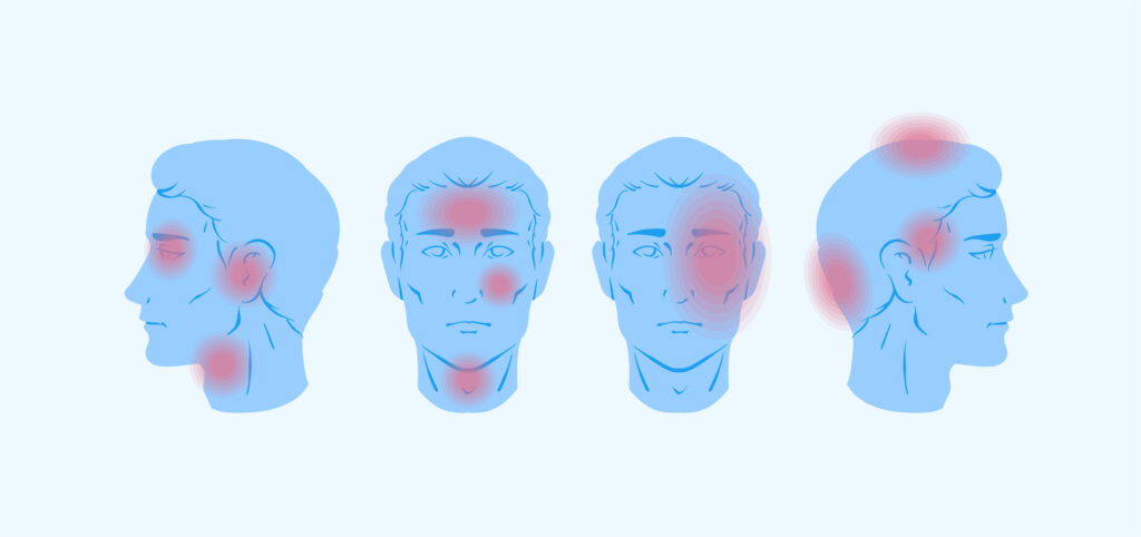Enxaqueca frequente não é normal: quando procurar um neurologista Enxaqueca frequente – quando procurar um neurologista